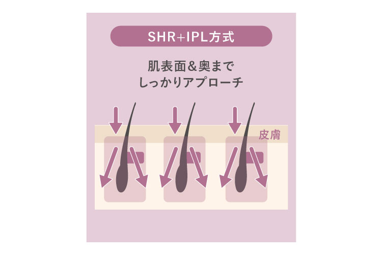 美と哲学　ジュピター　SHR+IPL方式